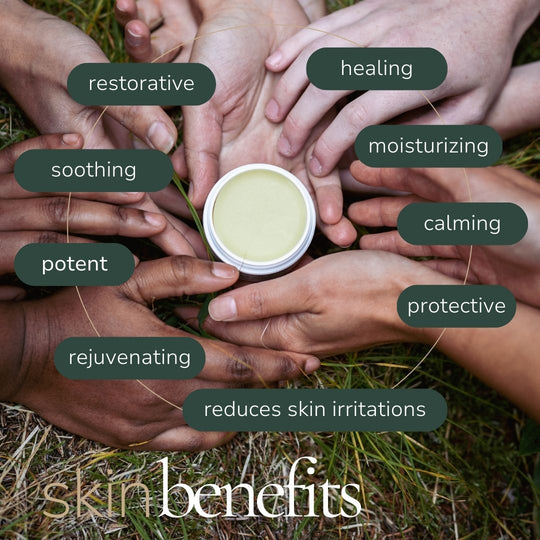 Calendula Skin Relief Salve - Balm & Salve - Cascadia Skincare
