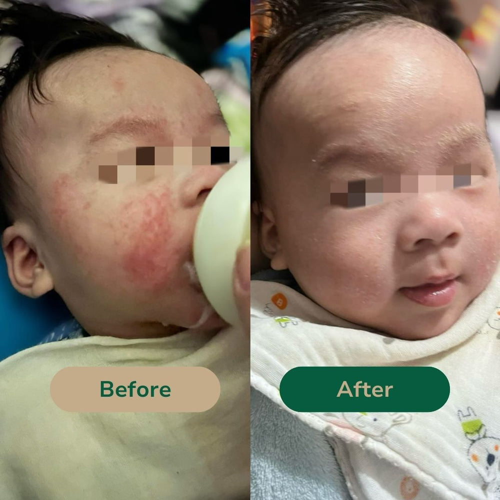 a baby's cheeks are shown before and after treatment with Cascadia Skincare Calendula Skin Relief Salve