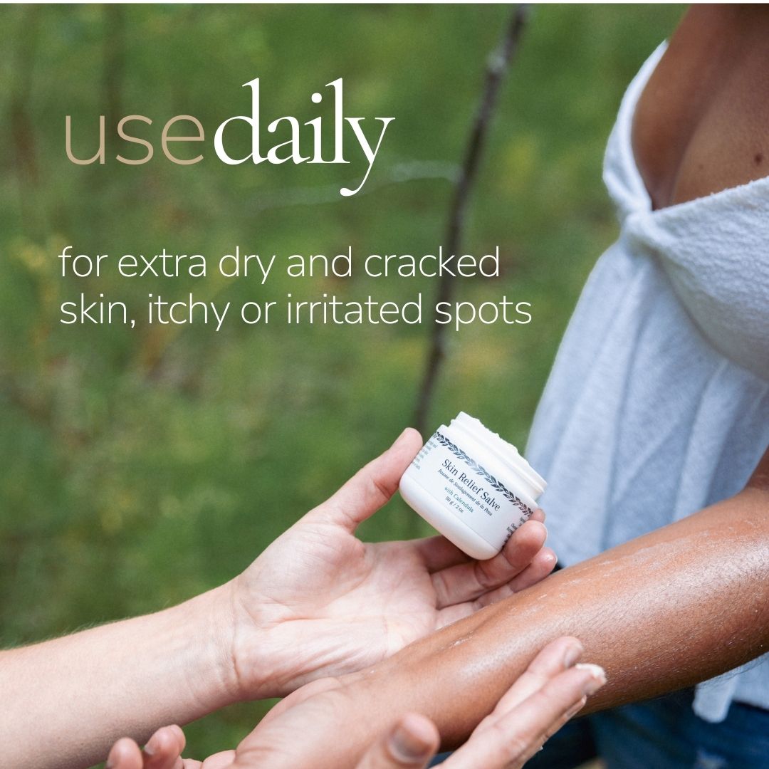 Calendula Skin Relief Salve